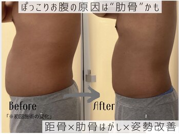 グランツ(glanz)/ぽっこりお腹解消◎初回施術写真