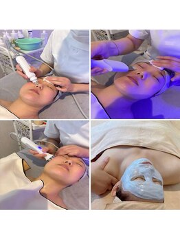 名城美容痩身整体専門サロンの写真/【水光肌★LHAララピール+デコルテリンパ70分 ￥9800】最強ツヤ肌☆毛穴の開き・黒ずみ・ニキビケアに◎