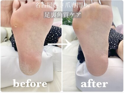 名古屋巻き爪専門Proの写真