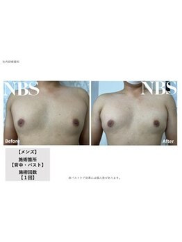 ダイアナ 出雲店(Daiana)/メンズバストケア