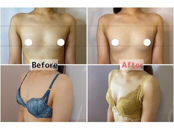 ロットプラス(Lot Plus)/Before→After（約半年の変化）