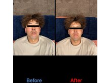 半蔵門駅前整体院/30代男性事例【小顔調整】