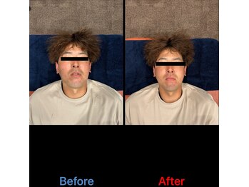 半蔵門駅前整体院/30代男性事例【小顔調整】