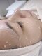エムイーボーテ(me.Beaute)の写真/【最短×最速  肌質改善ケア】ソフトピーリングで肌底からハリを与えてたるみ改善！継続で予防◎