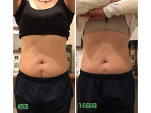 柏の葉オレンジ整体院/嬉しい♪お腹すっきり◎