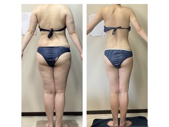 美ボディラボ(美Body Labo)/毛穴、ハーブピーリング、小顔