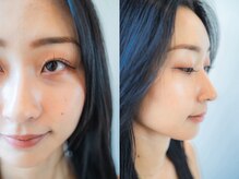 ユートゥイーズ 鎌倉(U too e's)の雰囲気（美眉スタイリングで美眉が叶う*似合わせ眉wax/眉カット/間引き）