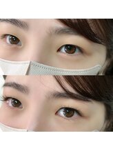 ナル(NaLu)/マツエク