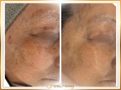 ロージー(ROSY)の写真