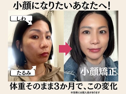 キッカ 岡山店(kikka)の写真