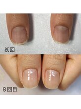 アイネイルズ(Ai nails)/形改善【ネイルケアコース】