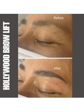 セラス(CERAS)/ハリウッドブロウリフト