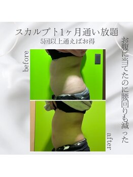 デール(R:DeeL)/スカルプト