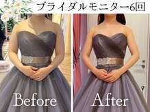 スリムプロ 天王寺店(Slimpro)/ブライダルエステ☆