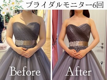 スリムプロ 天王寺店(Slimpro)/ブライダルエステ☆