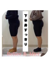 スタイルラボ高松/産後骨盤矯正の効果♪