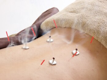 イーライフ鍼灸接骨院