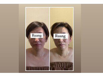 ルアン 八千代台店(Ruang)/チャクラフェイシャル効果写真