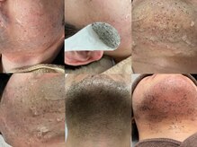 エリクサー 熊谷店(Elixir)/皆様はどんなおヒゲ？