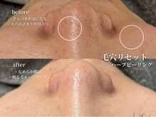 コウル 川西能勢口店(geoul)/毛穴レス美肌コース