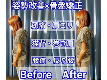 いのくち接骨院の雰囲気（痛みの原因となる体の歪み・姿勢を改善します。）