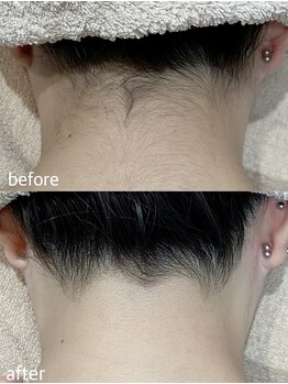 エムズスタイル ネイルバー(M's Style NAIL BAR)/うなじ脱毛