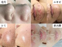 ヴィヴァンビー(Vivant+B)の雰囲気（美肌を目指す方と二人三脚！しっかりサポートいたします）