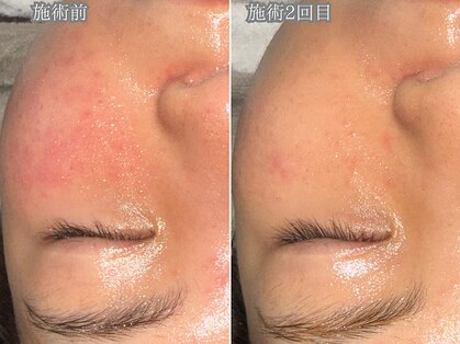 レイル(REIR)の写真