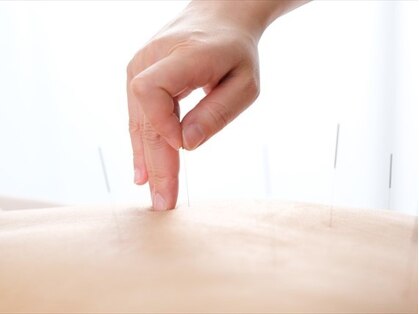 丹野鍼灸治療院の写真