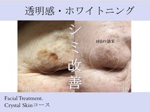 キレイラボ(Ki-Re-i LABO)/消えるんです★シミケアスポット