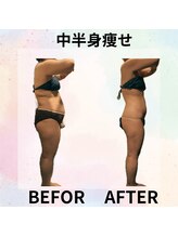 サロンド ヴィーナス 葛西店/中半身痩せで欲張りケア