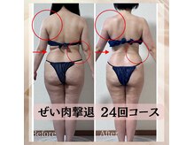 ハナ チュチュ(Hana chuchu)の雰囲気（セル脂肪撲滅 24回★40代女性　驚くほどの効果実感◎ダイエット）