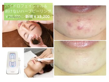 ルアナアイナ 池袋店(Luana Aina)/ハイドロ&ハーブピーリング