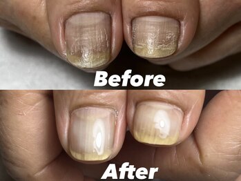 結(Yui)/自爪育成 Before→After