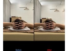 デン整骨院(DEN整骨院)/小顔矯正/ほうれい線/ゆがみ