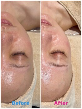 フィロ柏整骨院(Philo柏整骨院)/ビフォーアフター