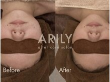 アリリィ(ARILY)/ARILY after care salon
