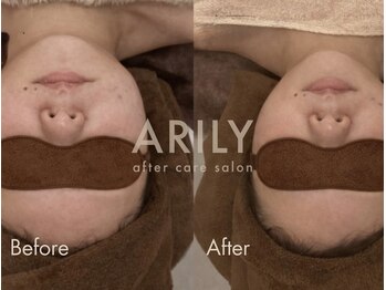 アリリィ(ARILY)/ARILY after care salon