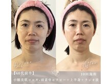 小顔美肌コルギ専門店 センティード 吉祥寺(Sentido)/