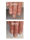 自爪ネイルケア