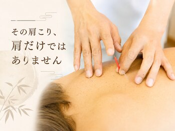 山鍼灸院の写真/全身を見て整えます！「つらい肩や首のこりには鍼灸」がおすすめ！気持ちよい鍼灸で体の疲れもスッキリ！