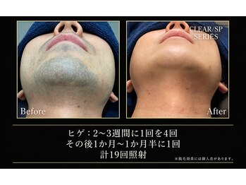 アンドミー(&mii)の写真/初心者でも！男性でもオススメサロンです♪