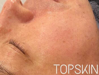トップスキン 新宿(TOPSKIN)/シミ/たるみ/毛穴‥肌悩み改善!