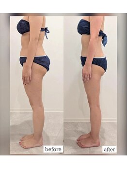 リアージュ(Riage)/お客様の変化