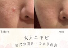 ソニョ(Sonyo)
