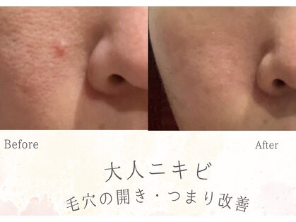 ソニョ(Sonyo)の写真