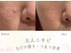 ソニョ(Sonyo)の写真