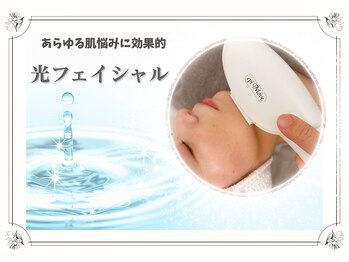 レモン(Lemon)/光フェイシャル