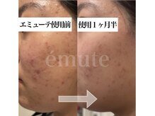 リュミエール デスポワール(Lumiere d'espoir)/ホームケア