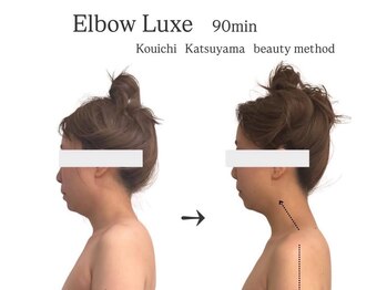 サロン ド マナ 神戸三宮店(salon de MANA)/最新の肘からの美容矯正！